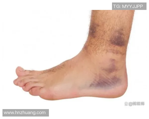 足球明星因脚踝扭伤缺席比赛的最新动态与伤情分析图片分享